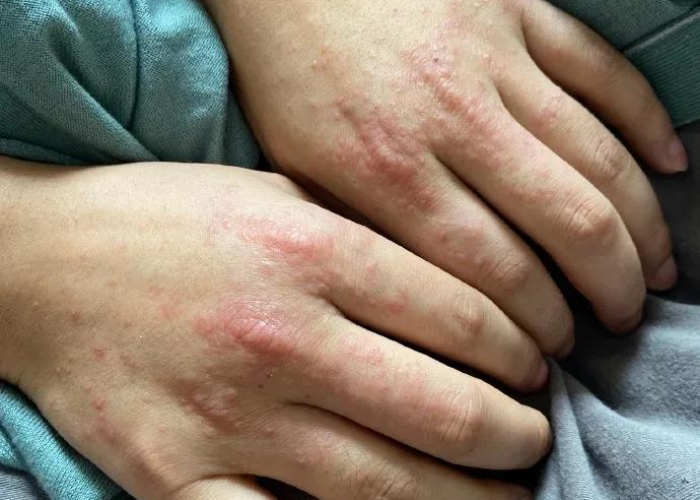 驻马店战疫新篇,科学精准筑防线,民生保障暖天中 驻马店战疫新篇,科学精准筑防线,民生保障暖天中