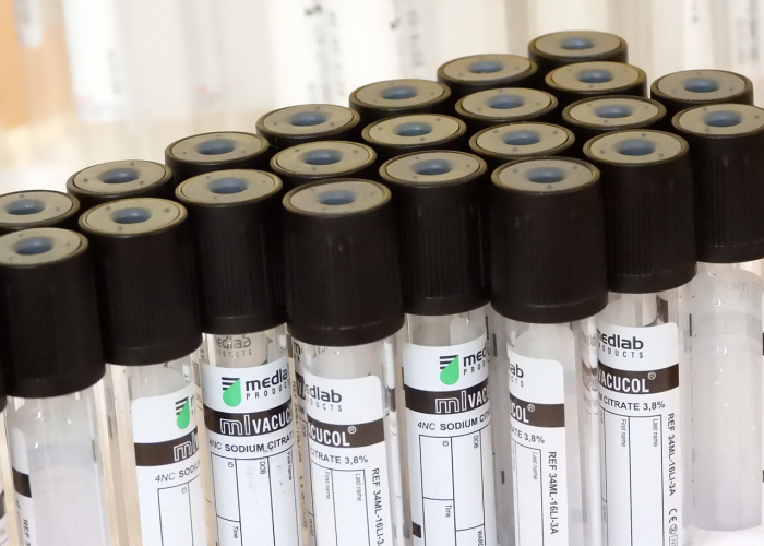 疫苗打科兴真的能瘦吗？揭秘科学真相与健康迷思